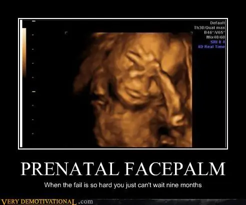 Facepalm el post merecido.