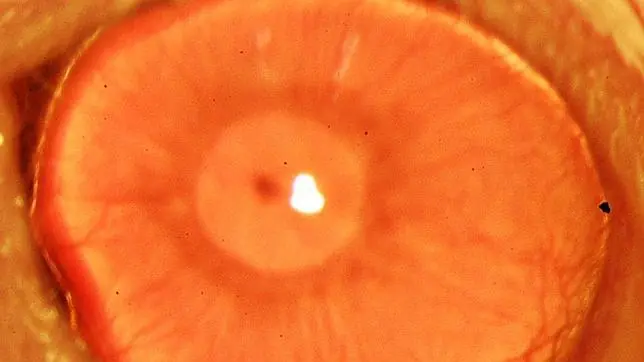 Regeneran una cornea humana con células madre