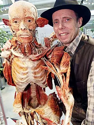 Plastinacion