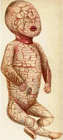 medicina