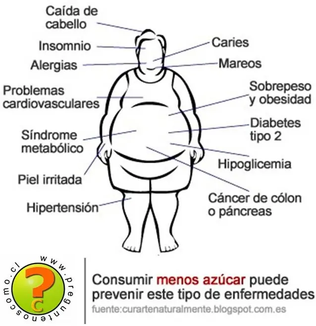 mundial