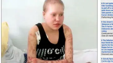 "Kokodril" la droga come carne