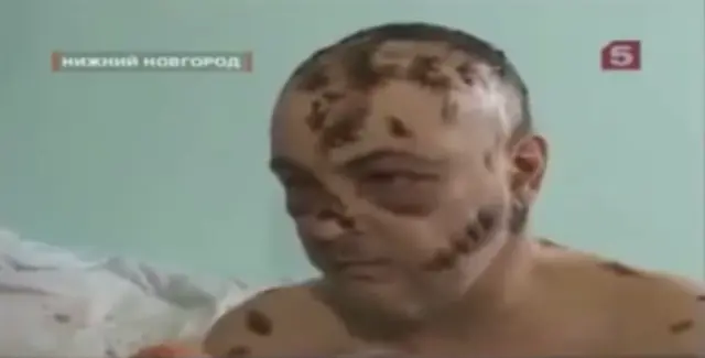 dolor
