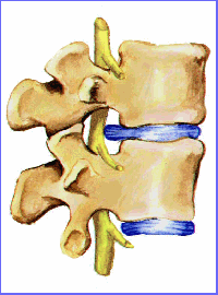 protrusion