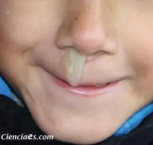 ¿Por qué los mocos son verdes?