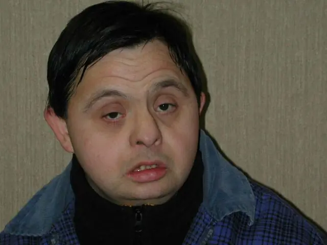 sindrome