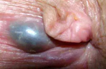 bienestar