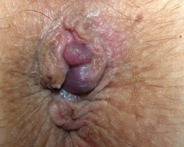 dolor