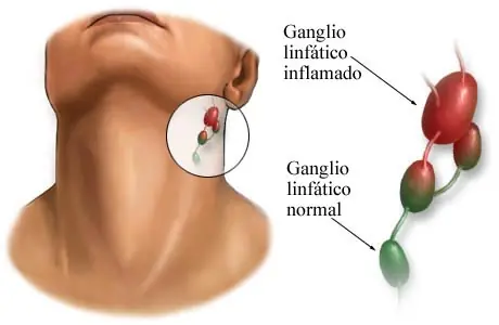 patologias comunes
