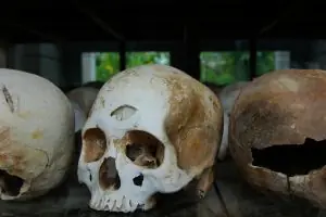 ¿Qué se siente al morir? Revelan 10 formas diferentes.