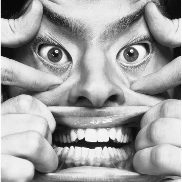 Famosos que arruinaron sus caras con cirugías