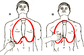 Reanimación Cardiopulmonar