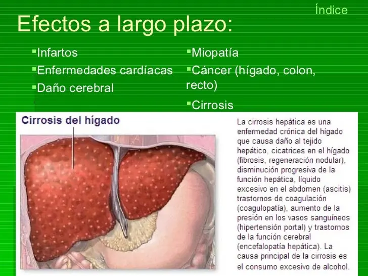 Alcoholismo los riesgos del alcohol entre los jóvenes