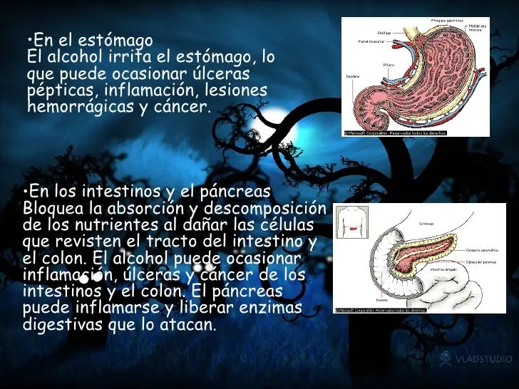 Consumo de alcohol