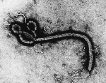 ¿Querés saber sobre el ébola? Entrá