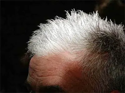 Canas - ¿Por qué salen? ¿Cual es su Causa?