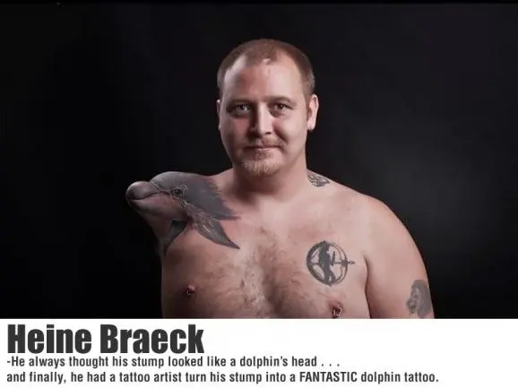 La belleza del arte aunque te falte una parte.