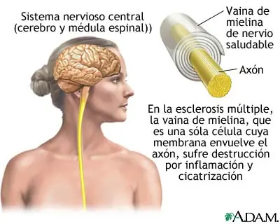 info