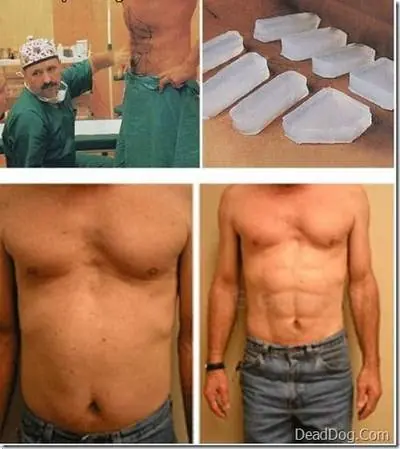 Los Hombres se hacen Implantes!