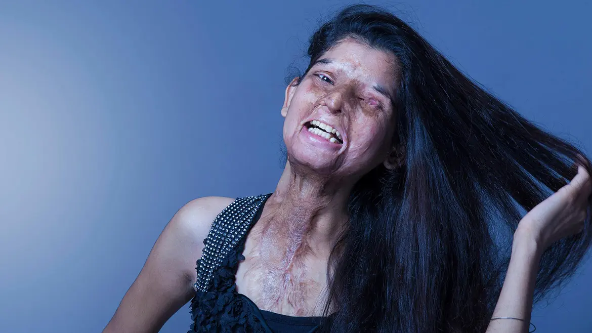 Víctimas de ataques con ácido se animaron a modelar