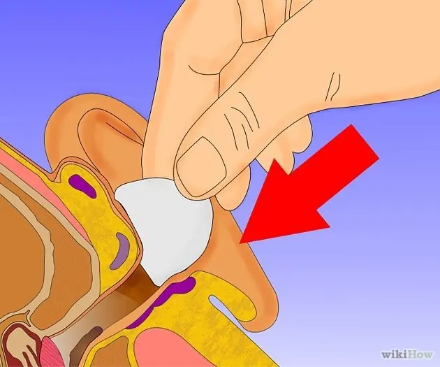 cerumen