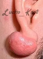 knot