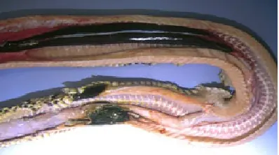 digestivo
