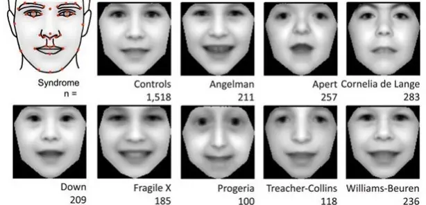 nuestros genes