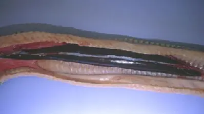 Aparato