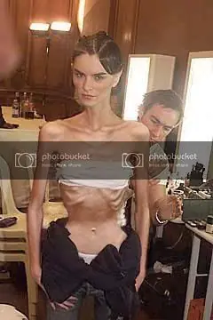 Ana y Mia: Detectemos la Bulimia y Anorexia