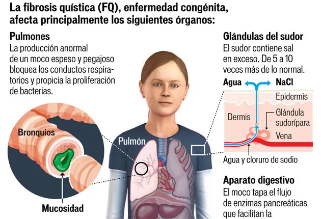 enfermedades geneticas