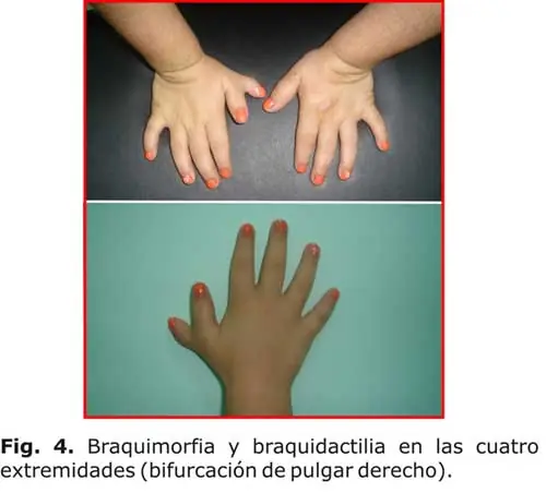 genetica humana
