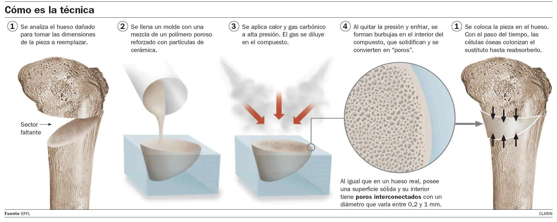 regeneración