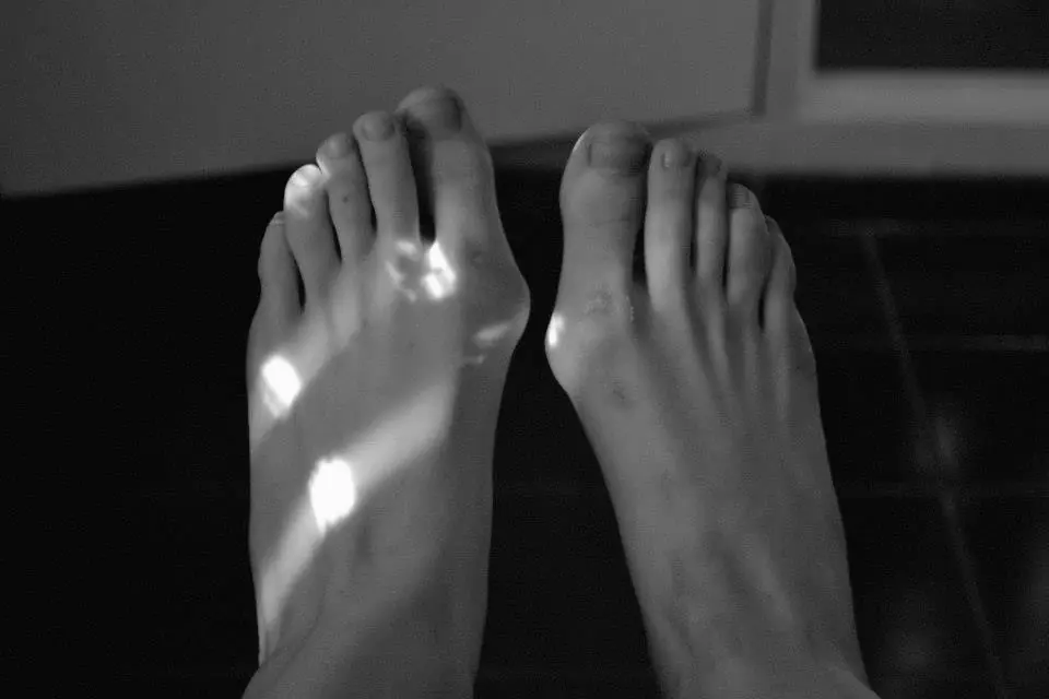 Blanco y Negro. Fotos propias