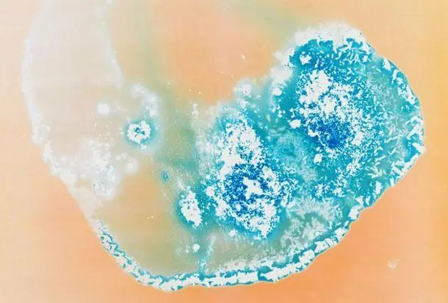 microscopio
