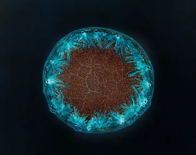 microscopio