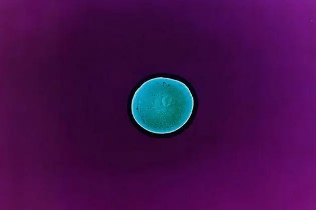 imagenes microscopicas
