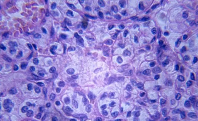 ¿Se puede inocular cáncer a una persona?