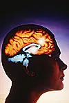 ¿que es la epilepsia? es conveniente estar informado