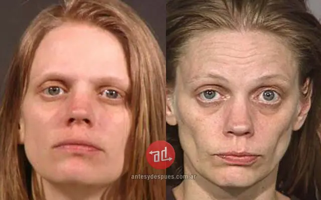 Antes y despues del consumo de drogas