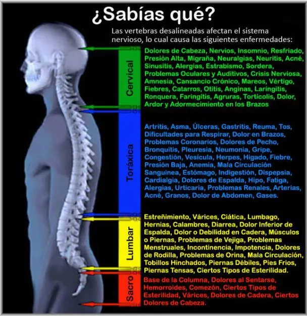 contractura