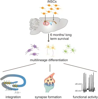 Primer implante exitoso de neuronas que se vuelven parte del