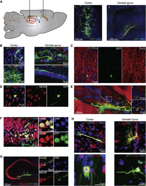 neuronas