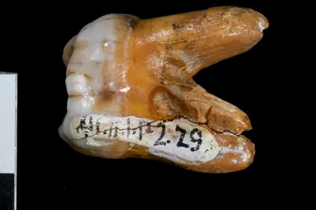 humana