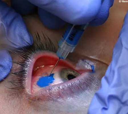 Tattoo en el ojo... imposible? Mira esto... TABÚ