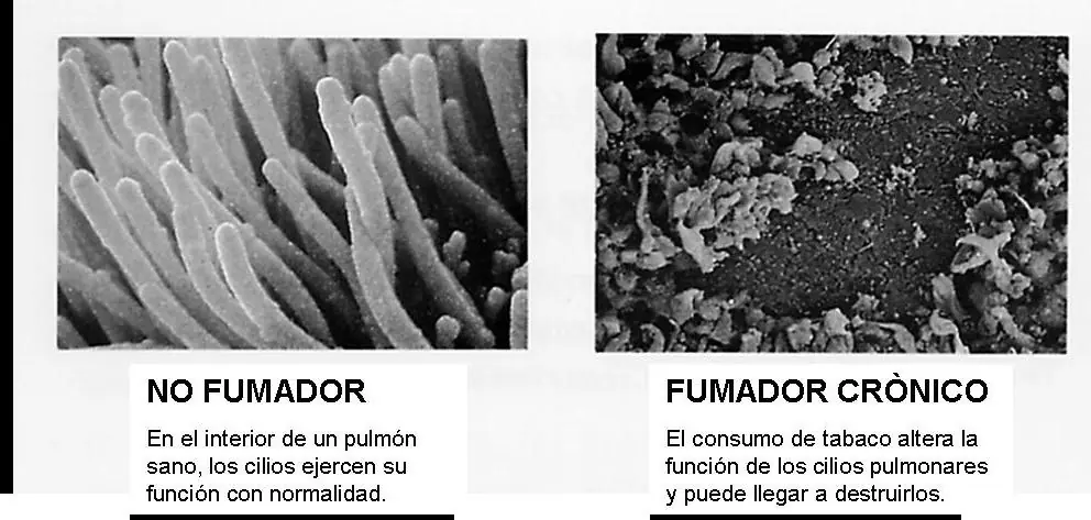 Dejar de fumar