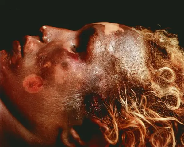 Andrés Serrano - The Morgue 1992