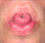 Las 16 diferencias genéticas más comunes en los seres huma