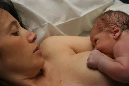 Todo lo que tenés que saber de una cesárea