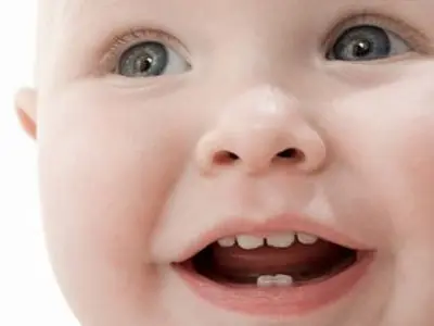Como cuidar los dientes de un bebe